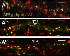 Fig.3.A showing Immunohistochemistry-immunofluorescence from the publication: Trophic factor BDNF inhibits GABAergic signaling by facilitating dendritic enrichment of SUMO E3 ligase PIAS3 and altering gephyrin scaffold.