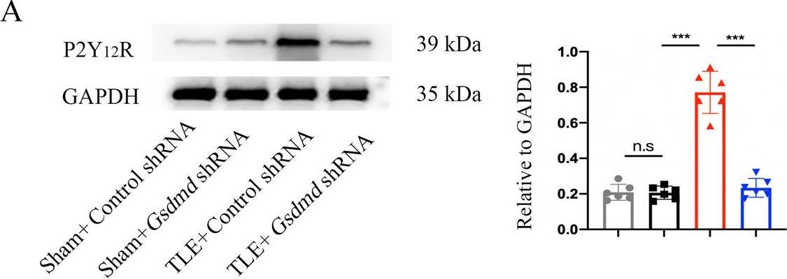 Fig.6.A showing Western Blotting from the publication: GSDMD knockdown attenuates phagocytic activity of microglia and exacerbates seizure susceptibility in TLE mice.