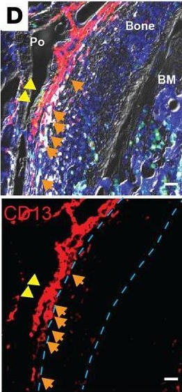 Fig.8.C from the publication: Identification of LRP1+CD13+ human periosteal stem cells that require LRP1 for bone repair.