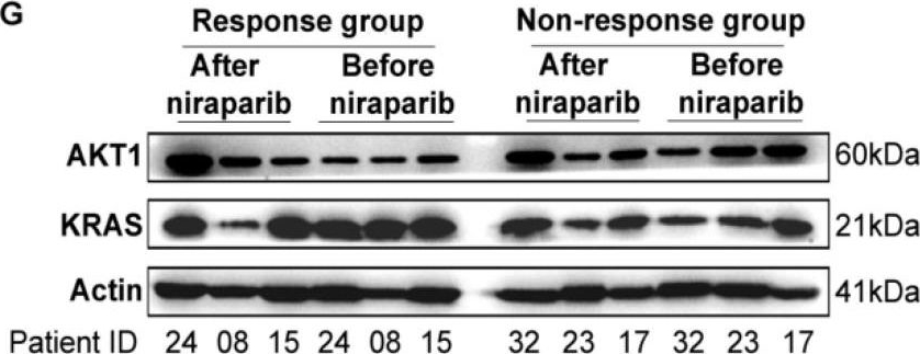 Fig.2.G showing Western Blotting from the publication: Using Patient-Derived Xenograft (PDX) Models as a 'Black Box' to Identify More Applicable Patients for ADP-Ribose Polymerase Inhibitor (PARPi) Treatment in Ovarian Cancer: Searching for Novel Molecular and Clinical Biomarkers and Performing a Prospective Preclinical Trial.