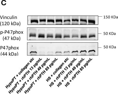 Fig.5.C showing Western Blotting from the publication: PTH-driven modulation of platelet activity via the NOX2 pathway in postsurgical hypoparathyroidism.