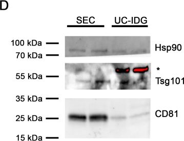 Fig.5.D showing Western Blotting from the publication: Improvement of small extracellular vesicle isolation from mouse model blood.
