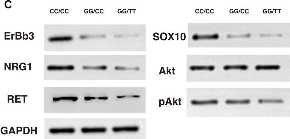 Fig.4.C showing Western Blotting in a Homo sapiens (Human) sample from the publication: The interplay of common genetic variants NRG1 rs2439302 and RET rs2435357 increases the risk of developing Hirschsprung's disease.