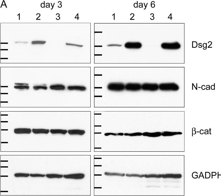 Desmoglein 2 depletion leads to increased migration and upregulation of the chemoattractant secretoneurin in melanoma cells.