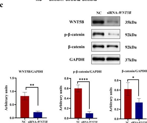 Fig.9.C showing Western Blotting from the publication: The SCD5 Gene Modulates Adipogenic Differentiation via the WNT5B Signaling Pathway in Xinjiang Brown Cattle.