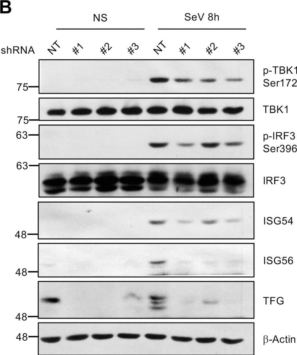 Fig.5.B showing Western Blotting in a Homo sapiens (Human) sample from the publication: TRK-Fused Gene (TFG), a protein involved in protein secretion pathways, is an essential component of the antiviral innate immune response.