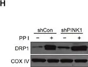 Fig.4.H showing Western Blotting in a Homo sapiens (Human) sample from the publication: Polyphyllin I induces mitophagic and apoptotic cell death in human breast cancer cells by increasing mitochondrial PINK1 levels.