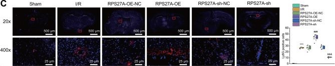 Fig.4.C showing Immunohistochemistry-immunofluorescence in a Mus musculus (House mouse) sample from the publication: Modulating the RPS27A/PSMD12/NF-κB pathway to control immune response in mouse brain ischemia-reperfusion injury.