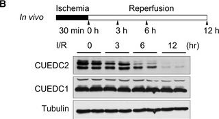 Fig.1.B showing Western Blotting in a Mus musculus (House mouse) sample from the publication: CUEDC2 modulates cardiomyocyte oxidative capacity by regulating GPX1 stability.