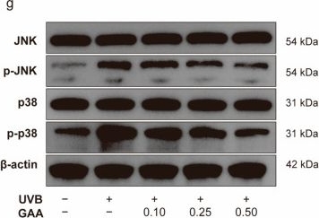 Fig.4.G showing Western Blotting from the publication: Ganoderic Acid A Reverses Ultraviolet B Induced Hyperpigmentation via Multi-Targeted Regulation of Mitochondrial Homeostasis and Inflammation.