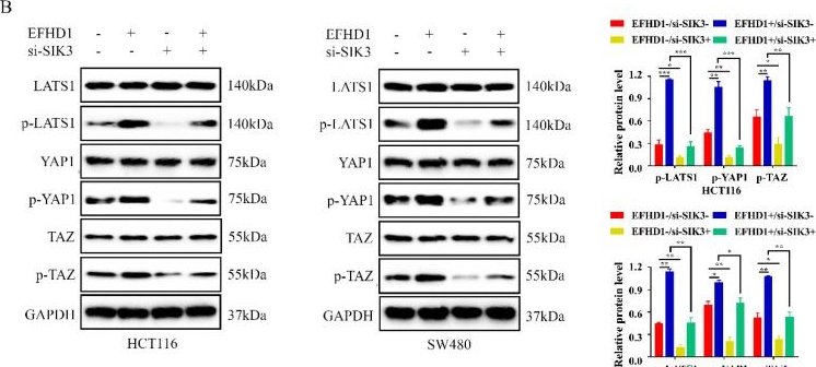 Fig.6.B showing Western Blotting in a Homo sapiens (Human) sample from the publication: EFHD1 Activates SIK3 to Limit Colorectal Cancer Initiation and Progression via the Hippo Pathway.