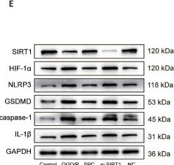 Fig.5.E showing Western Blotting in a Mus musculus (House mouse) sample from the publication: Anesthetic gas sevoflurane postconditioning alleviates cognitive impairment induced by hemorrhagic shock and resuscitation.