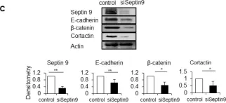 Fig.2.C showing Western Blotting in a Canis lupus familiaris (Domestic dog) sample from the publication: Septin 9 Orients the Apico-Basal Polarity Axis and Controls Plasticity Signals.