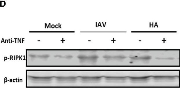 Fig.3.D showing Western Blotting in a Mus musculus (House mouse) sample from the publication: Severe influenza infection is associated with inflammatory programmed cell death in infected macrophages.