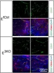 Fig.1.E showing Immunofluorescence in a Mus musculus (House mouse) sample from the publication: Suppression of ischemia in arterial occlusive disease by JNK-promoted native collateral artery development.