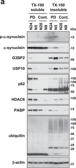 G3BP1 inhibits ubiquitinated protein aggregations induced by p62 and USP10.