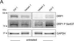 Fig.3.A showing Western Blotting from the publication: Converging Role for REEP1/SPG31 in Oxidative Stress.