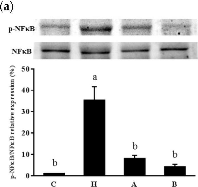 Fig.5.A showing Western Blotting in a Rattus norvegicus (Rat) sample from the publication: Renoprotective Effects of Antroquinonol in Rats with Nω-Nitro-l-Arginine Methyl Ester-Induced Hypertension.