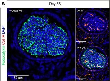 Fig.3.A showing Immunohistochemistry-immunofluorescence from the publication: Splice modulation of COL4A5 reinstates collagen IV assembly in an organoid model of Alport syndrome.