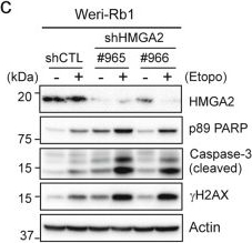 Fig.5.C showing Western Blotting in a Mus musculus (House mouse) sample from the publication: Targeting of histone methyltransferase DOT1L plays a dual role in chemosensitization of retinoblastoma cells and enhances the efficacy of chemotherapy.