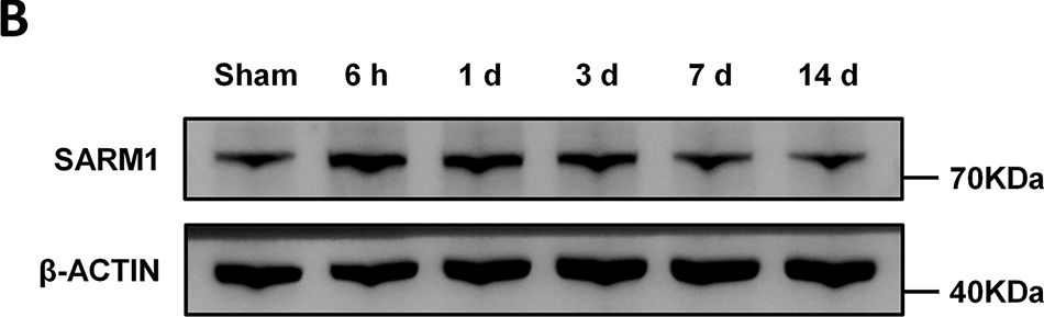 Fig.1.B showing Western Blotting from the publication: Deficiency of SARM1 attenuates neuronal injury and improves neurological performance in a photothrombotic stroke model.