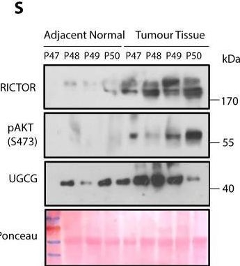 Fig.1.S showing Western Blotting in a Homo sapiens (Human) sample from the publication: The mTORC2 subunit RICTOR drives breast cancer progression by promoting ganglioside biosynthesis through transcriptional and epigenetic mechanisms.