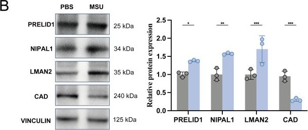 Fig.5.B showing Western Blotting from the publication: Integrated multi-omics mapping of the causal landscape of gout across the circulating-tissue axis.