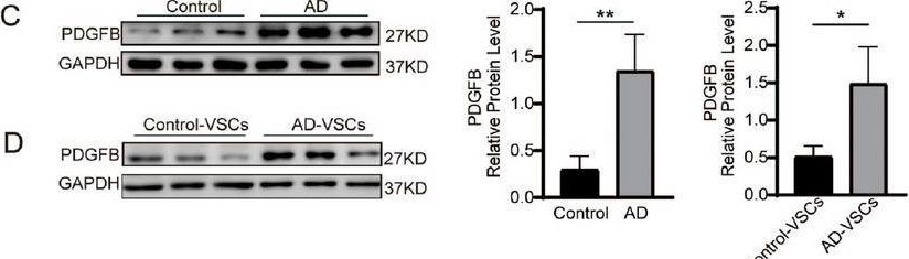 Fig.7.C showing Western Blotting in a Homo sapiens (Human) sample from the publication: Single-Cell RNA-Seq Reveals Injuries in Aortic Dissection and Identifies PDGF Signalling Pathway as a Potential Therapeutic Target.