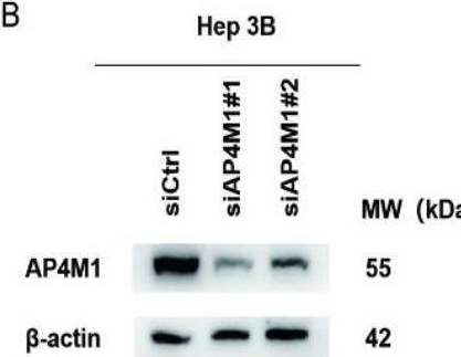 Fig.8.B showing Western Blotting from the publication: AP4M1 as a prognostic biomarker associated with cell proliferation, migration and immune regulation in hepatocellular carcinoma.