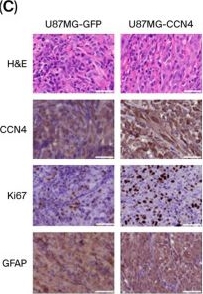 Fig.3.C showing Immunohistochemistry from the publication: In Vivo ORF Overexpression Screening Identifies CCN4 as a Regulator of Glioblastoma Growth Validated Across Multiple Models.