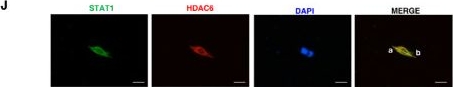 Fig.5.J showing Immunocytochemistry-immunofluorescence in a Homo sapiens (Human) sample from the publication: HDAC6 inhibitor ACY-1215 enhances STAT1 acetylation to block PD-L1 for colorectal cancer immunotherapy.