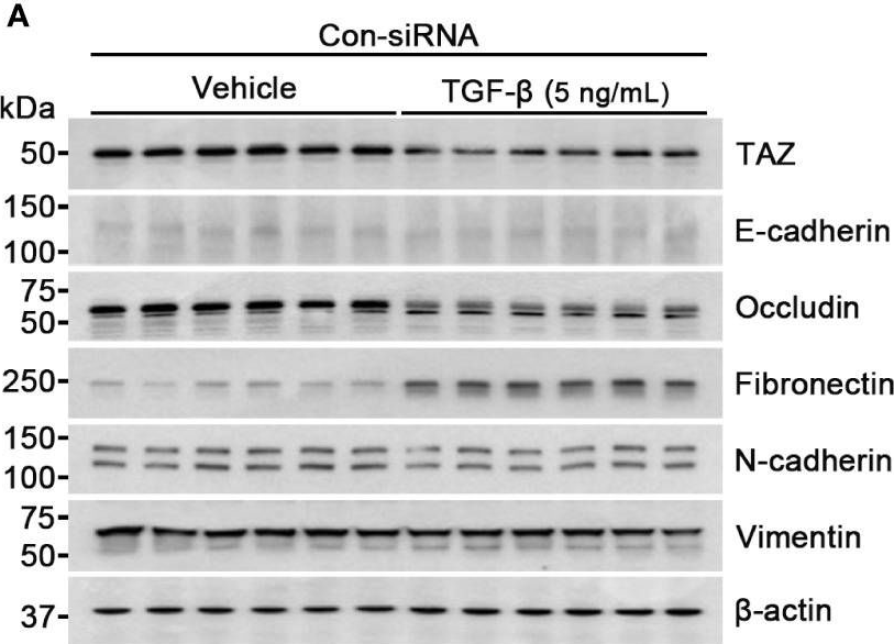 Fig.3.A showing Western Blotting in a Homo sapiens (Human) sample from the publication: TAZ is involved in breast cancer cell migration via regulating actin dynamics.