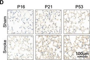 Fig.6.D showing Immunohistochemistry from the publication: Cigarette Smoke-Induced Alveolar Macrophage Senescence via GEM/SIRT3-Mediated Mitochondrial Dysfunction.