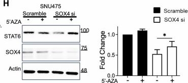 Fig.1.H showing Western Blotting in a Homo sapiens (Human) sample from the publication: SOX4-STAT6-MTHFD2 axis drives hepatocellular carcinoma progression and treatment resistance.