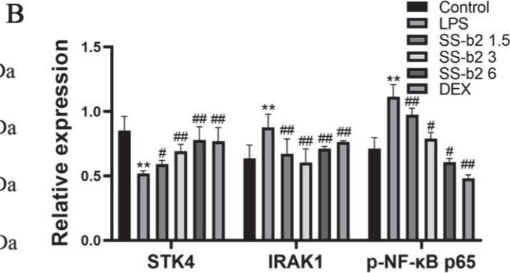 Fig.6.B from the publication: Saikosaponin-b2 Inhibits Primary Liver Cancer by Regulating the STK4/IRAK1/NF-κB Pathway.