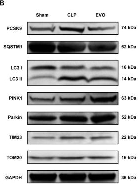 Fig.5.B showing Western Blotting from the publication: PCSK9 inhibition alleviates sepsis-induced myocardial dysfunction by facilitating PINK1/parkin-associated mitophagy.