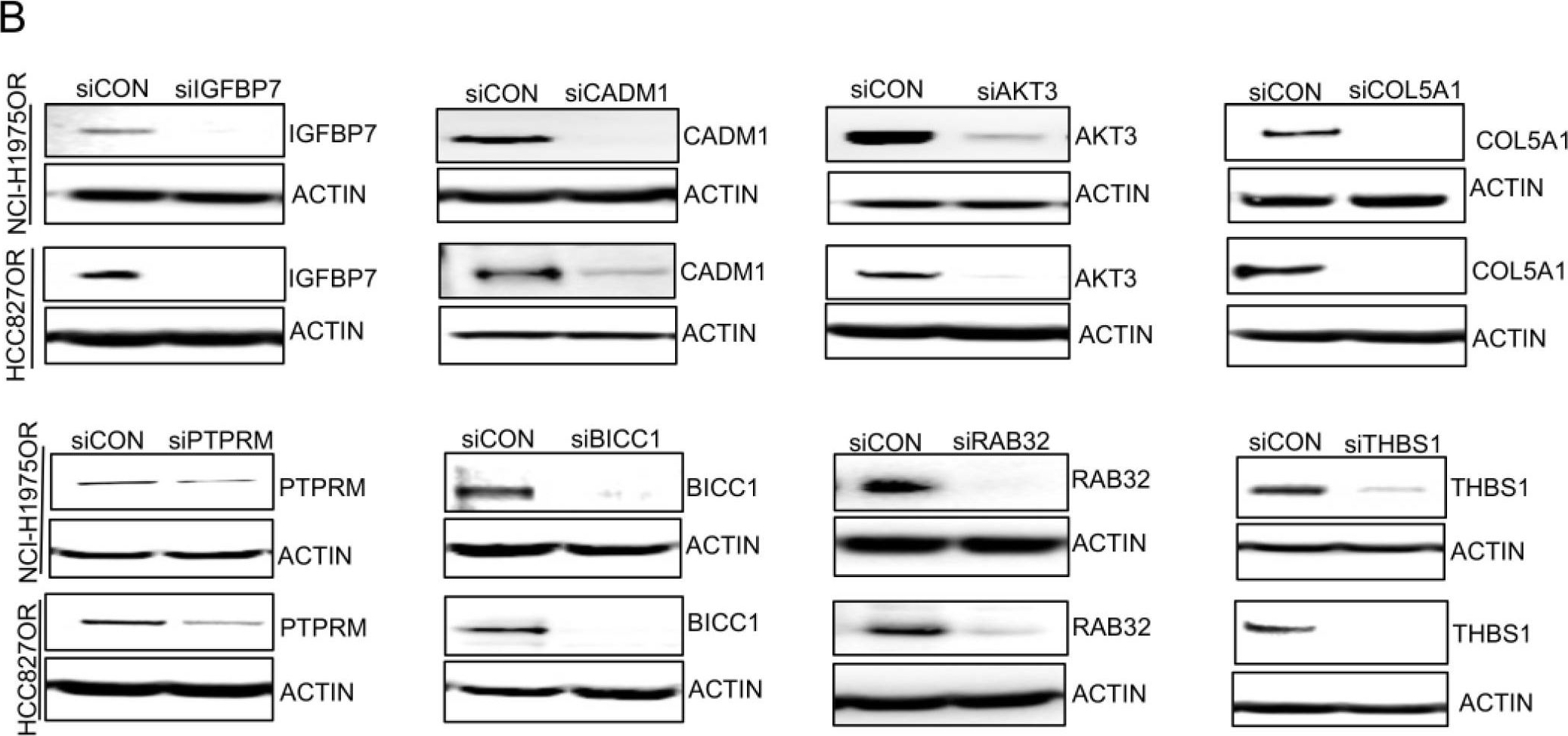 Fig.5.B showing Western Blotting in a Homo sapiens (Human) sample from the publication: Ras-Related Protein Rab-32 and Thrombospondin 1 Confer Resistance to the EGFR Tyrosine Kinase Inhibitor Osimertinib by Activating Focal Adhesion Kinase in Non-Small Cell Lung Cancer.