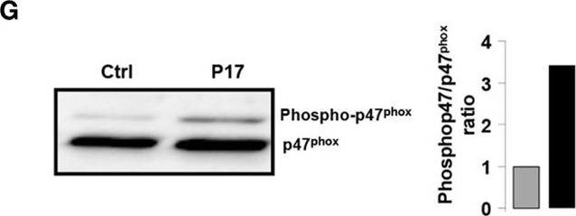 Fig.1.G showing Western Blotting in a Homo sapiens (Human) sample from the publication: P17, an Original Host Defense Peptide from Ant Venom, Promotes Antifungal Activities of Macrophages through the Induction of C-Type Lectin Receptors Dependent on LTB4-Mediated PPARγ Activation.
