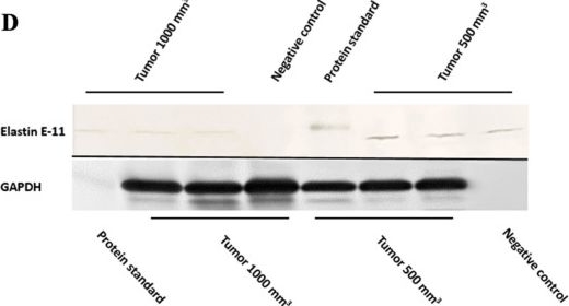 Fig.4.D showing Western Blotting from the publication: Visualization and Quantification of the Extracellular Matrix in Prostate Cancer Using an Elastin Specific Molecular Probe.