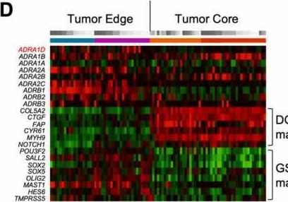 Fig.6.D showing Immunohistochemistry-immunofluorescence from the publication: Changes in adrenoceptor expression level contribute to the cellular plasticity of glioblastoma cells.