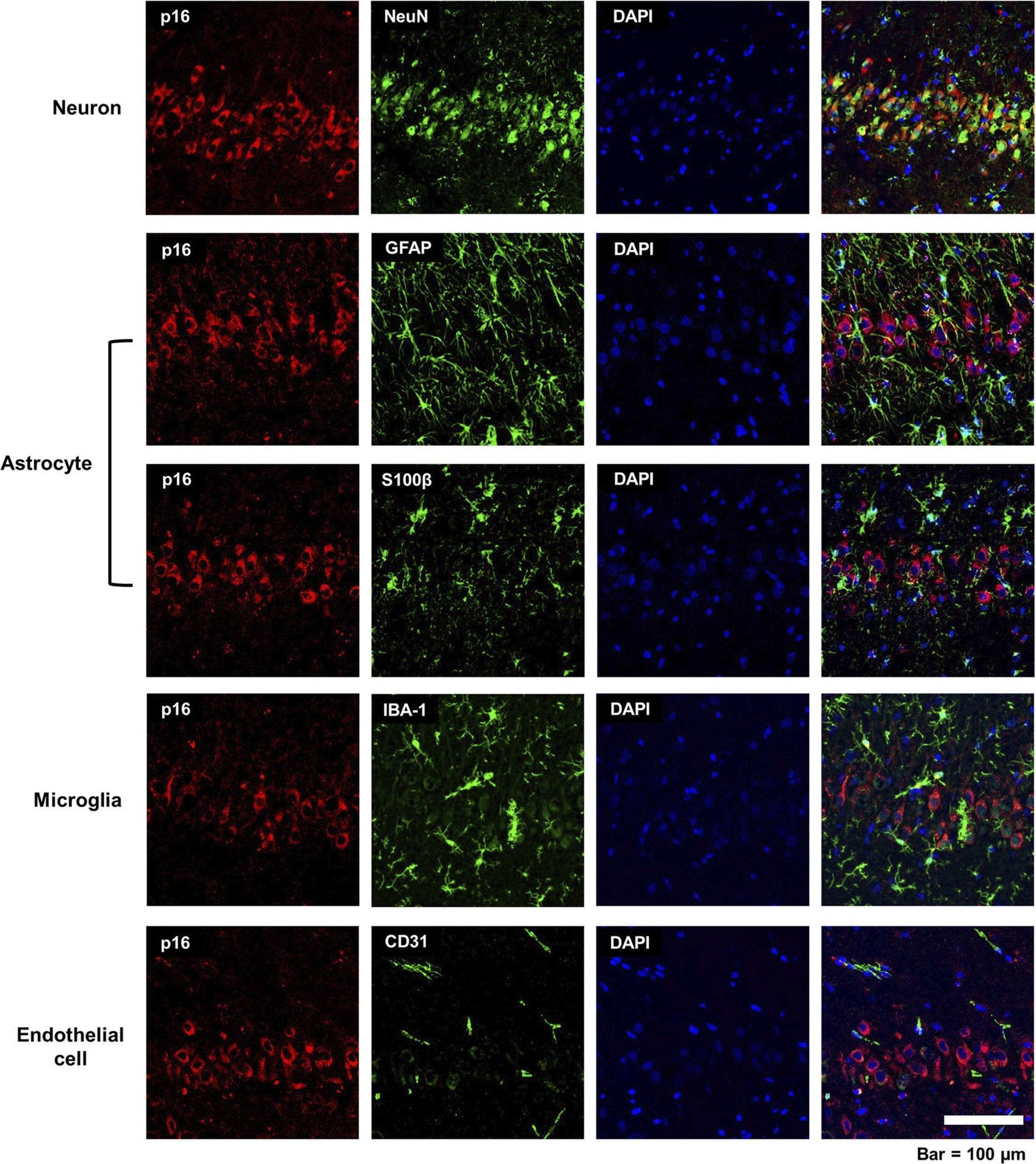 Fig.3.A showing Immunocytochemistry in a Rattus norvegicus (Rat) sample from the publication: Acute intoxication with diisopropylfluorophosphate promotes cellular senescence in the adult male rat brain.