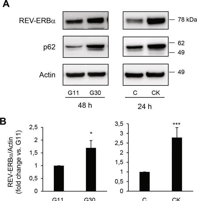 The nuclear receptor REV-ERBα is implicated in the alteration of β-cell autophagy and survival under diabetogenic conditions.