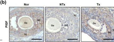 Fig.3.B showing Immunohistochemistry from the publication: Placental Growth Factor Secreted from Placenta-Derived Mesenchymal Stem Cells Improves Ovarian Function in TAA-Injured Rats via Antioxidant Effects.