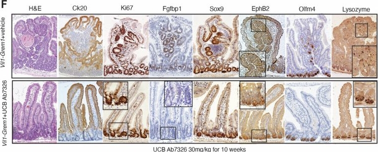 Fig.2.F showing Immunohistochemistry in a Mus musculus (House mouse) sample from the publication: Epithelial GREMLIN1 disrupts intestinal epithelial-mesenchymal crosstalk to induce a wnt-dependent ectopic stem cell niche through stromal remodelling.
