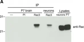 Fig.1.A showing Western Blotting in a Mus musculus (House mouse) sample from the publication: Rac1 and Rac3 GTPases differently influence the morphological maturation of dendritic spines in hippocampal neurons.