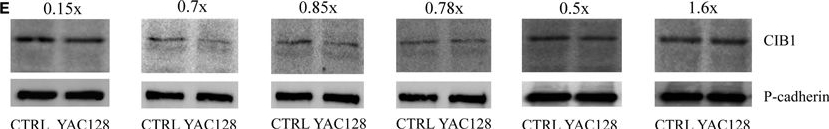 Fig.2.E showing Western Blotting in a Mus musculus (House mouse) sample from the publication: Expression of genes encoding the calcium signalosome in cellular and transgenic models of Huntington's disease.