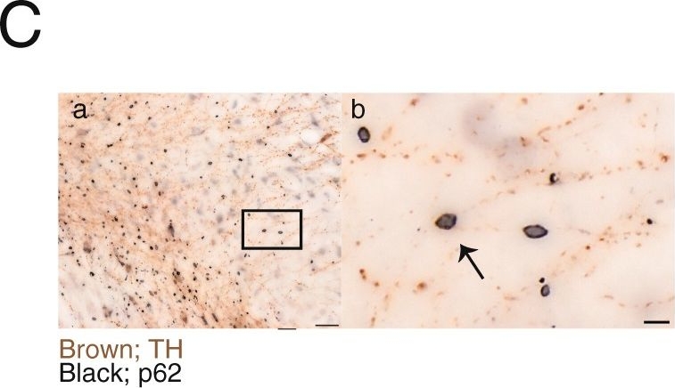 Loss of autophagy in dopaminergic neurons causes Lewy pathology and motor dysfunction in aged mice.