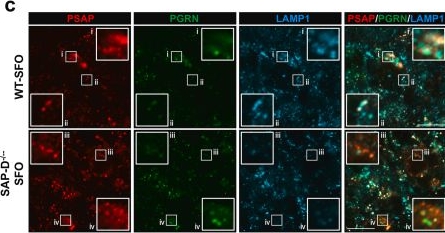 Fig.4.C showing Immunohistochemistry-immunofluorescence from the publication: Accumulation of prosaposin and progranulin around the subfornical organ induces polydipsia in SAP-D-deficient mice.