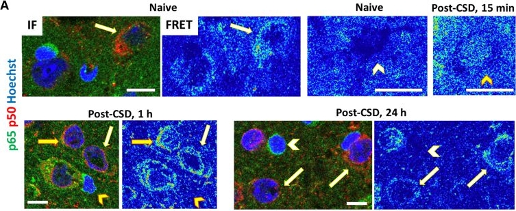 Fig.7.A showing Immunohistochemistry-immunofluorescence from the publication: Spreading depolarization triggers pro- and anti-inflammatory signalling: a potential link to headache.