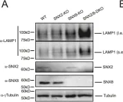 Fig.3.A showing Western Blotting from the publication: SNX8 enables lysosome reformation and reverses lysosomal storage disorder.